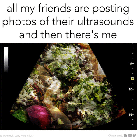 ultrasound.gif